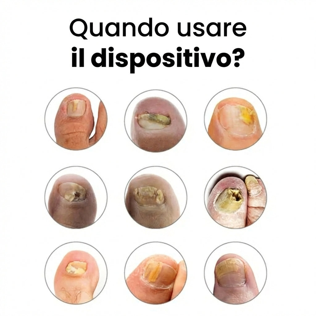 BellaVita - Elimina le micosi in 7 giorni